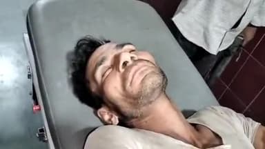 मुरादाबाद: ठाकुरद्वारा थाना क्षेत्र में काम करके वापस लौट रहे मजदूर को तेज रफ्तार अज्ञात वाहन ने मारी टक्कर मजदूर  हुआ घायल