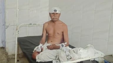 बीना: ग्राम गुनगी में 75 वर्षीय वृद्ध के साथ कई लोगों ने की मारपीट, गंभीर हालत में वृद्ध सागर जिला अस्पताल रेफर