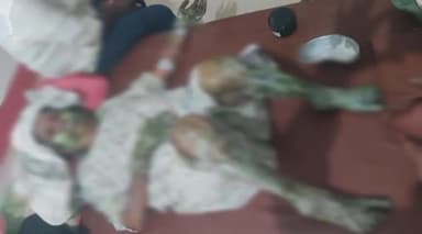 भिनगा: चरगहिया गांव के बाहर गेहूं के खेत में लगी आग,बुझाने गई एक महिला गंभीर रूप से झुलसी