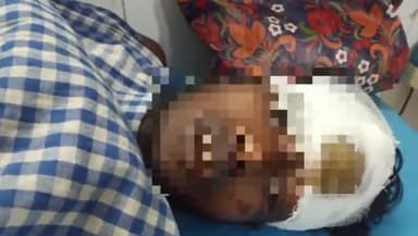 जमुई: मानपुर के पास ऑटो व बाइक की टक्कर में दो युवक घायल, सदर अस्पताल में कराया भर्ती