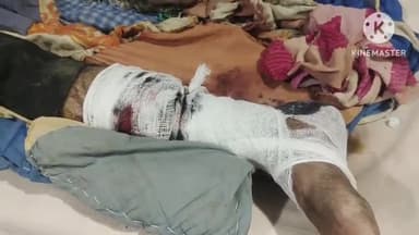 फिरोज़ाबाद: थाना खैरगढ क्षेत्र कनवारा चौराहा पर तेज रफ्तार बाइक ने पैदल निकलते मैकेनिक को मारी टक्कर, गंभीर घायल