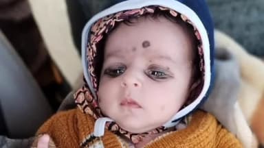 मंदसौर: मंदसौर जिला अस्पताल में डिलीवरी के दौरान डॉक्टरों की लापरवाही से नवजात बच्ची को गंभीर कट लगा इलाज जारी है