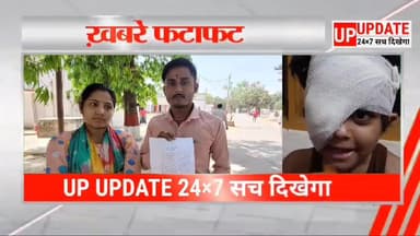 पीलीभीत के बैनर पब्लिक स्कूल में पेंसिल लगने से छात्रा की आंख फूटी, आंख फूटने से हालत गंभीर