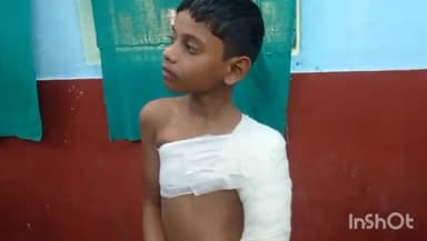 नुआंव: अखिनी में पेड़ से आम तोड़ने के दौरान 11 वर्षीय बच्चा गिरकर गंभीर रूप से हुआ घायल रेफरल अस्पताल में कराया गया इलाज