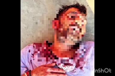 बरेली: करेली गोटिया निवासी व्यक्ति पर छोटे भाई ने अपने सालों के साथ मिलकर किया जानलेवा हमला, व्यक्ति हुआ गंभीर घायल