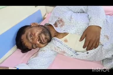 बरेली: सिरौली थाना क्षेत्र में जाति बिरादरी को लेकर युवक को दबंगों ने जमकर पीटा जिला अस्पताल में कराया भर्ती