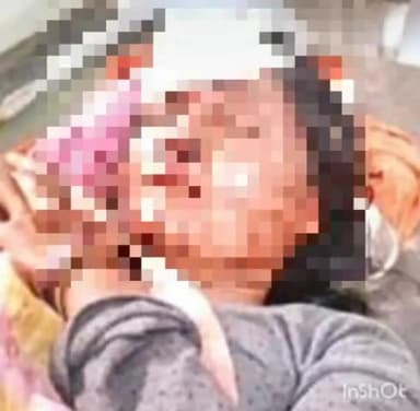 चितरंगी: ग्राम शिवपुरवा निवासी एक अधेड़ महिला तेंदूपत्ता तोड़ते समय पेड़ से गिरी, गंभीर रूप से हुई घायल