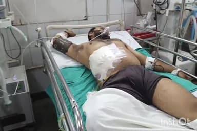 बरेली: सेटेलाइट पर होटल के बाहर बैठकर शराब पी रहे दो दोस्तों में झगड़े के बाद चली गोली, दोनों घायल निजी अस्पताल में भर्ती