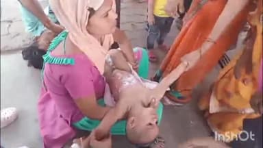 हाथरस: गांव हतिसा में घर में खेलते समय डेढ़ वर्षीय बच्चें के ऊपर गिरा खोलता गर्म दूध जिला अस्पताल से किया आगरा रेफर