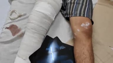 लाडपुरा: कोटा सांगोद मार्ग पर ट्रैक्टर की टक्कर से बाइक सवार पिता-पुत्र हुए घायल, एमबीएस अस्पताल में भर्ती