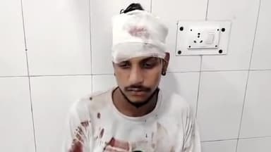 मुरादाबाद: सिविल लाइन थाना क्षेत्र में काम करके वापस आ रहे युवक के साथ 4 से 5 युवकों ने पुरानी रंजिश के चलते की मारपीट