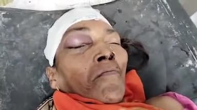 मुरादाबाद: मझोला थाना क्षेत्र में बीच रस्ते में गली में गाड़ी खड़ी होने पर हटाने को कहने पर मां बेटे ने लगाया तीन लोगो पर आरोप