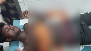 मीनापुर: मीनापुर गांव में आपसी विवाद में दो गुटों में चाकू बाजी में दो व्यक्ति घायल हो गया ।