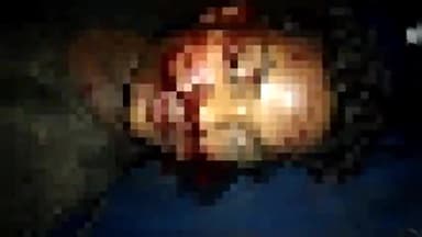 कोंडागांव: गोलावंड में तेज रफ्तार बाइक पेड़ से टकराने पर एक युवक की हुई दर्दनाक मौत, हादसे में दो नाबालिग घायल