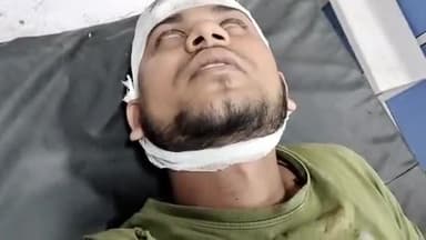 मुरादाबाद: पाकबड़ा थाना क्षेत्र में दीवार को लेकर पड़ोसियों ने की युवक को साथ की मारपीट युवक हुआ घायल