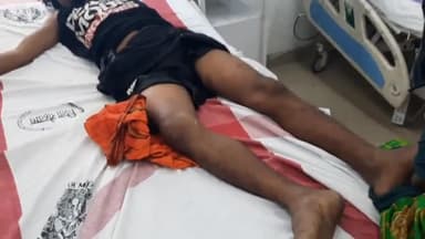 अकोढ़ी गोला: बांक गांव में दो बाइक में हुई टक्कर, बाइक सवार एक व्यक्ति हुए घायल