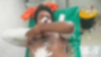 चित्तौड़गढ़: हाड़ों का खेड़ा में करंट की चपेट में आने से ठेका कर्मचारी झुलसा-उदयपुर रेफर, गलती से चढ़ गया था चालू लाइन पर