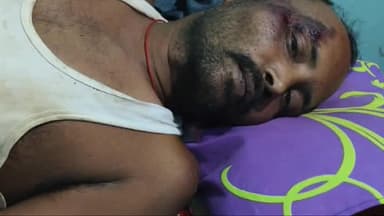 हज़ारीबाग: झुंड से बिछड़ा हाथी ने युवक को पटक कर किया घायल