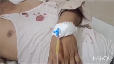 लाडपुरा: नयापुरा राजकीय महाविद्यालय के निकट बाइक सवार अधेड़ दम्पत्ति को कार ने टक्कर मारी हुए घायल एमबीएस अस्पताल में भर्ती