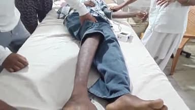 ठेठईटांगर: ताराबोगा में जहरीले सांप के काटने से एक युवक की बिगड़ी हालत