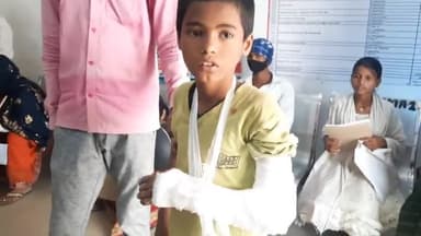 तिलौथू: दतौली गांव में अनियंत्रित ऑटो ने एक 9 वर्षीय लड़का को मारी टक्कर लड़का हुआ घायल