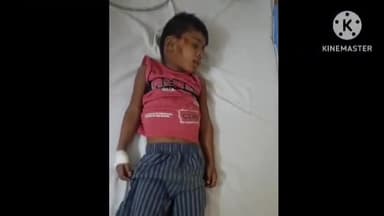 निज़ामाबाद: खरेवा गांव में बने अंडर पास में 5 वर्षीय बालक गिरकर हुआ गंभीरपुर से घायल,परिजनों ने कराया अस्पताल में भर्ती