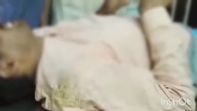 सिरोंज: वार्ड क्रमांक 17 में घर में खाना बनाते समय आग में झुलसा युवक, अस्पताल में उपचार जारी