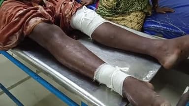 ক্যানিং ১: বেলেগাছি মোড়ের কাছে রোলারে ধাক্কা অটোর, আহত ৫ জন