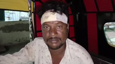 ক্যানিং ১: পাঙ্গাসখালি গ্রামে পাওনা টাকা চাওয়ায় প্রতিবেশীর হাতে আক্রান্ত ব্যক্তি, থানায় অভিযোগ দায়ের