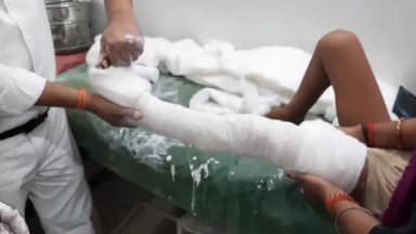 सासाराम: सासाराम के एसपी जैन कॉलेज रोड़ में अनियंत्रित बाइक ने एक 10 वर्षीय लड़की को मारी टक्कर, लड़की हुई घायल