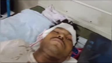 पीपलदा: कोटा श्योपुर मार्ग पर तेज रफ्तार मोटरसाइकिल अनियंत्रित होकर फिसलने से एक युवक हुआ घायल, MBS अस्पताल में भर्ती