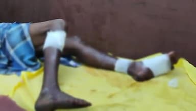 कोंडागांव: ग्राम कुकाड़ गारकापाल में छोटे भाई ने बड़े भाई पर किया लोहे के सब्बल से जानलेवा हमला, घायल का जिला अस्पताल में इलाज जारी