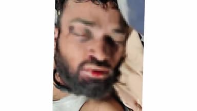 एत्मादपुर: थाना एत्मादपुर क्षेत्र के झरना नाले के समीप एक अज्ञात व्यक्ति का मिला शव, पुलिस ने शव को पोस्टमार्टम हेतु भेजा