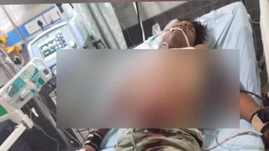 सरधना: युवक के सीने में दबंग ने घोंपा भाला गंभीर हालत में युवक अस्पताल भर्ती गांव समसपुर सुरानी का मामला