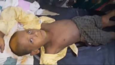 अररिया: मिर्जाभाग में बिजली के तार की चपेट में आने से एक बालक हुआ अचेत सदर अस्पताल में भर्ती