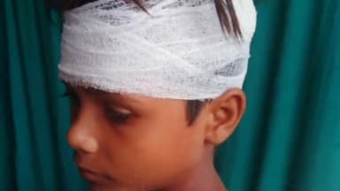 नरवल: कुंदौली गांव में जातिसूचक गाली का विरोध करने पर दबंगों ने नाबालिग पर किया जानलेवा हमला, गंभीर रूप से हुआ घायल