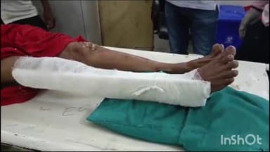 रायबरेली: जैतूपुर की रहने वृद्ध महिला पर आवारा घोड़े ने किया हमला,जिला अस्पताल में कराया गया भर्ती