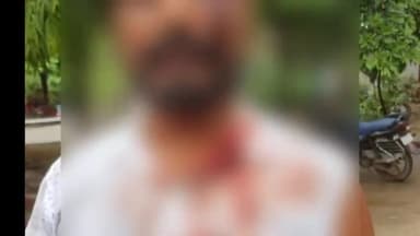 मंझनपुर: जमीनी रंजिश के चलते घात लगाए बैठे लोगों ने रॉयल्टी कुआं के पास एक शख्स को जमकर पीटा पुलिस ने नहीं की सुनवाई