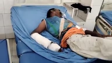 मुरादाबाद: मझोला थाना क्षेत्र में सड़क किनारे घायल अवस्था में पड़े अज्ञात व्यक्ति को पुलिस ने,  इलाज के लिए भर्ती कराया