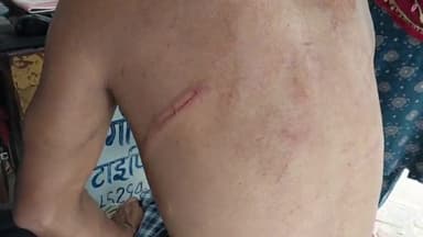 पूरनपुर: मोहल्ला रजागंज में तीन लोगों ने की एक युवक की पिटाई, पीड़ित ने कोतवाली पुलिस से की शिकायत