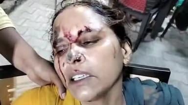 मुरादाबाद: कटघर थाना क्षेत्र में कुत्ते को मारने का विरोध करने पर 3 से 4 लोगों ने महिला के साथ की मारपीट