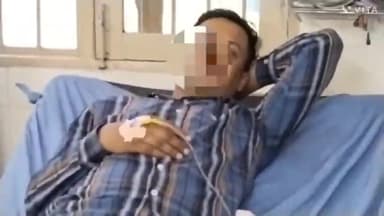 मुलाना: मुलाना में बाथरूम में छिपे सांप ने व्यक्ति को डंस, सिविल अस्पताल में उपचार जारी