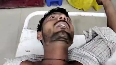 मुरादाबाद: सिविल लाइन थाना क्षेत्र में पुरानी रंजिश के चलते 4-5 लोगों ने एक युवक को पीटकर किया घायल, पीड़ित ने पुलिस को दी तहरीर