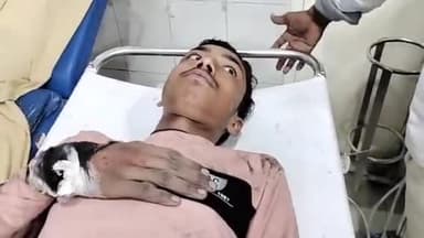 मुरादाबाद: मूंढापांडे थाना क्षेत्र में बारिश होने के चलते बाइक फिसल गई युवक हुआ, घायल