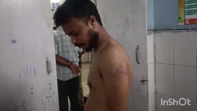 लखीसराय: हकीमगंज गांव में घरेलू विवाद के दौरान हुई मारपीट में एक युवक घायल, सदर अस्पताल में किया गया उपचार