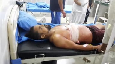 पूर्णागिरि: टनकपुर के ग्राम पंचायत नायकगोठ में भतीजे नें चाचा कों मारी गोली, हालत गंभीर किया रैफर