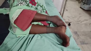 ठेठईटांगर: बैगा टोली में जहरीले सांप के काटने से महिला की हालत हुई गंभीर