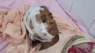 रामपुर: ग्राम टांडा हुर्मतनगर में बेसहारा पशु मोटरसाइकिल के सामने आने से हुआ हादसा, एक महिला घायल व जिला अस्पताल में भर्ती