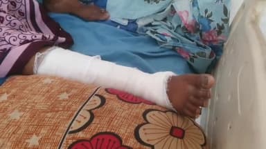 रामपुर: जेल रोड के पास सड़क किनारे आम खरीद रही महिला को टेंपो ने मारी टक्कर महिला घायल जिला अस्पताल में भर्ती