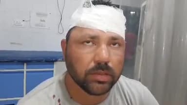 मुरादाबाद: सिविल लाइन थाना क्षेत्र में पिता के साथ मारपीट होता देख बीच-बचाव करने गए व्यक्ति को कुछ लोगों ने पीटा, पीड़ित ने दी तहरीर